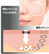 黒色メラニンはシミになります。