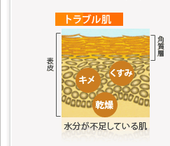 トラブル肌