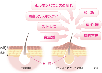 肌イメージ図